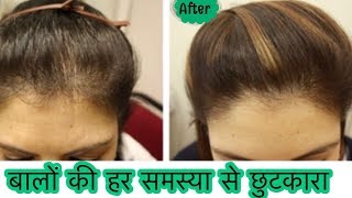 Watch DIY Hair Growth Oil - Stop Hair Fall, Hair Loss | How to grow Long Thick Hair Naturally Video