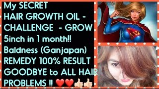 Watch DIY HAIR GROWTH OIL for LONG  HAIR -  upto 4-5 inch in 1 month | ONE HAIR OIL for ALL Hair Problems! Video