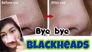 Watch Remove Blackheads/Whiteheads Naturally - Demo | JSuper Kaur Video