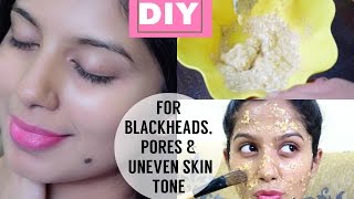 Watch DIY Scrub for Blackheads, Uneven Skin Tone and Pores Video