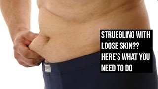 Watch Get rid of Loose Skin After Weight Loss - Only Truth No B.S. Video