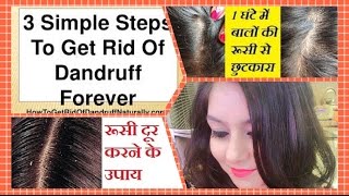 Watch Miracle Cure For Dandruff & Hair Fall | MAGICAL HOME REMEDY to TREAT DANDRUFF at HOME | JSuper Kaur Video
