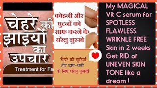 Watch DIY Vitamin C serum in Rs.10 for FLAWLESS SPOTLESS skin | Get rid of DARK knees elbows | 100% RESULT Video
