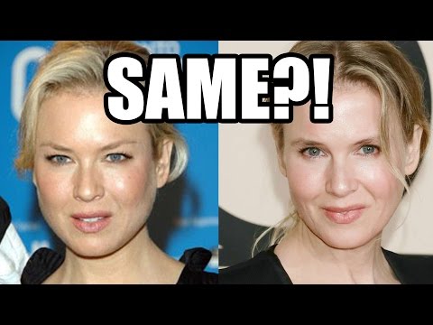 Watch Renee Zellweger Debuts New Face...At Least We Think ItÃ¢â‚¬â„¢s Renee Zellweger | HollyscoopNews Video