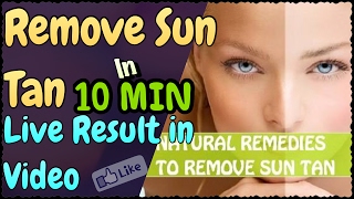 Watch How to Remove Sun Tan from your Face & Hand | Home Remedies to Remove Sun Tan Easy &  Quickly Video