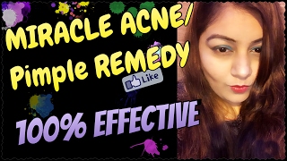 Watch How To Remove Pimples/Acne | Remove Acne Marks | Treatment at Home & Instant Result | Jsuper Kaur Video