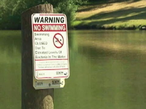 Watch Health Scare Closes Park Near Seattle News Video Video