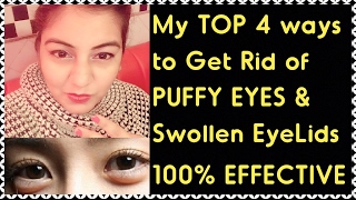 Watch How to Get Rid of PUFFY EYES, SWOLLEN EYELIDS, DARK CIRCLES & EYE BAGS - with DEMO | 100% RESULT Video