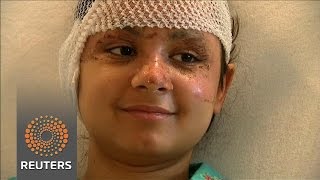 Watch Brussels bombing victim remembers ordeal News Video Video