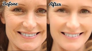 Watch How to Remove Wrinkles - à¤à¥à¤°à¥à¤°à¤¿à¤¯à¥‹à¤‚ à¤¸à¥‡ à¤›à¥à¤Ÿà¤•à¤¾à¤°à¤¾ - Anti Ageing Night Cream DIY | JSuper Kaur Video