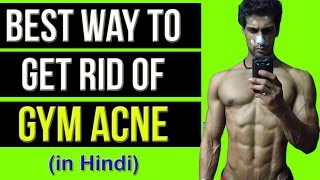Watch Get Rid of ACNE as a GYMMER (in Hindi) | Too much ACNE BODYBUILDING Problem | Abhinav Mahajan Video