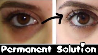 Watch How to Remove Dark Circles Naturally Permanently - in 3 days ????JSuper Kaur Video