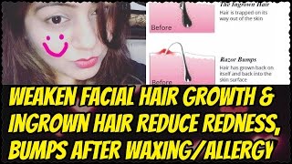 Watch Home Remedy for Ingrown Hair, Pimples, Redness after Waxing | Weaken Facial Hair Growth Naturally Video