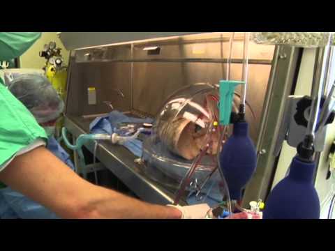 Watch Study: Sudden Deaths May Increase Lung Donations News Video Video
