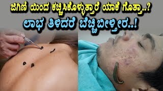 Watch à²œà²¿à²—à²£à³†à²¯à²¿à²‚à²¦ à²•à²šà³à²šà²¿à²¸à²¿à²•à³Šà²‚à²¡à³à²°à³† à²¬à²°à³à²µ à²²à²¾à²­ | Health Benefits of leech therapy | Health Videos Kannada Video