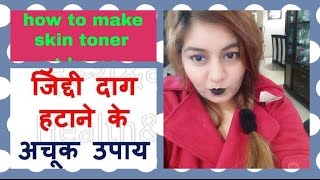 Watch My PIMPLE skin care routine | DIY MAGICAL toner for Acne under Rs.30 | à¤®à¥à¤¹à¤à¤¸à¥‹à¤‚ à¤­à¤°à¥€ à¤¤à¥à¤µà¤šà¤¾ à¤•à¥€ à¤¦à¥‡à¤–à¤­à¤¾à¤² à¥¤ Video